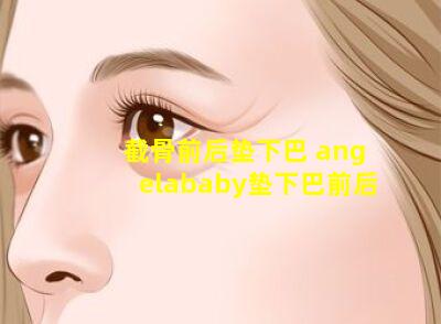 截骨前后垫下巴 angelababy垫下巴前后